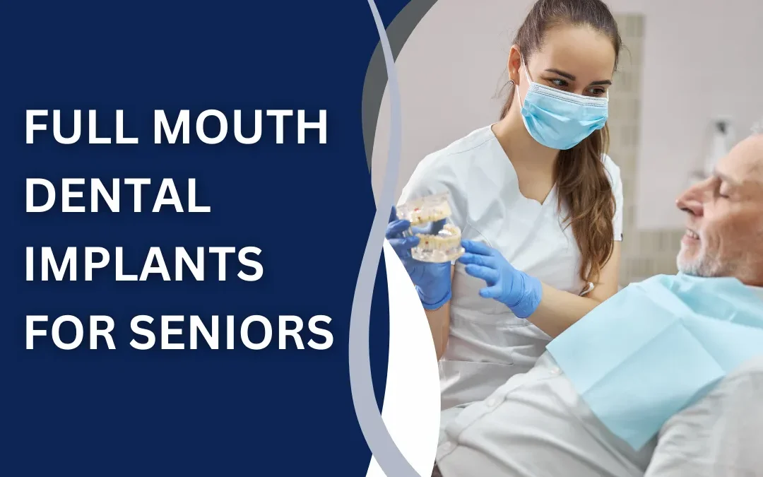 Full Mouth Dental Implants for Seniors