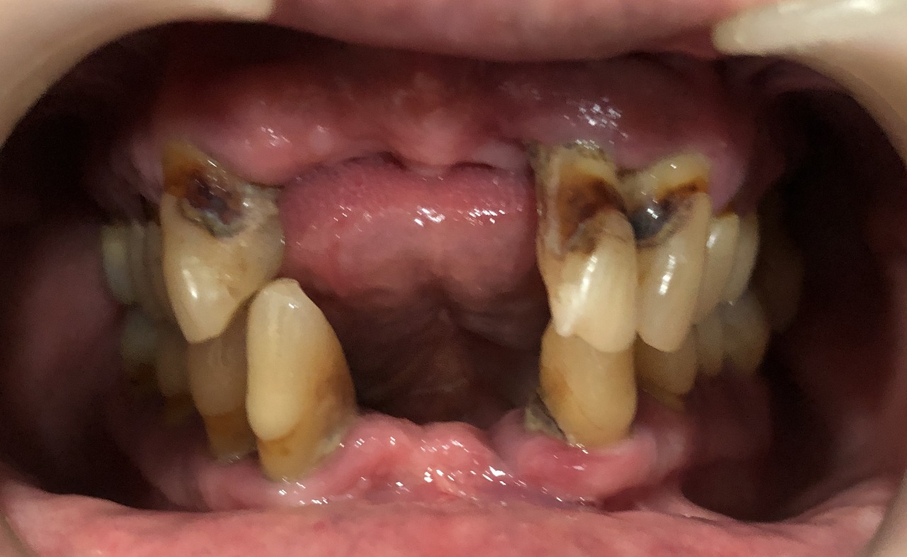 Picture2