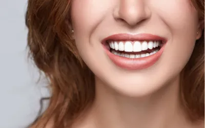 Smile make over - Dental Creations smile-makeover