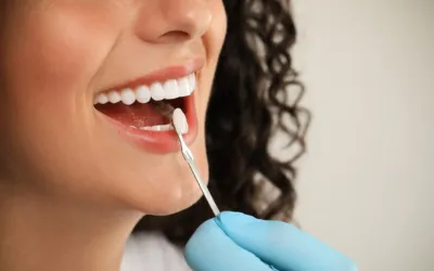 Veneers Cosmetic Dentistry - Dental Creations