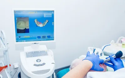 CADCAM Crowns - Dental Creations