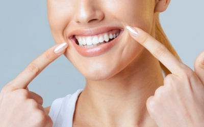 Smile-Makeover