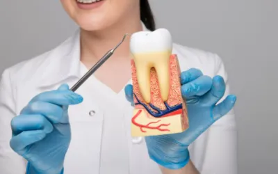 Aggressive-Periodontitis