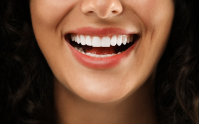 Teeth whitening