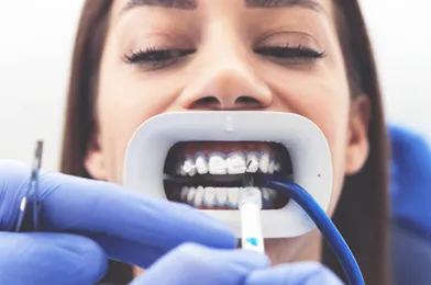 teeth-whitening