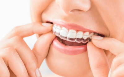Orthodontic Treatment 1 - Dental Creations
