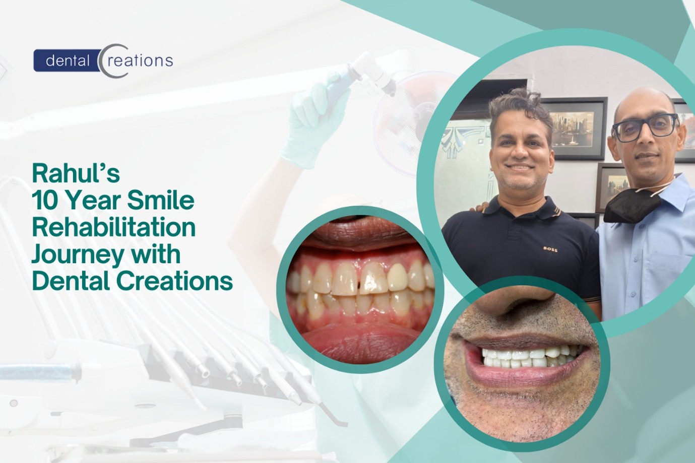 Replacing Missing Teeth and<br />
Restoring Oral Function