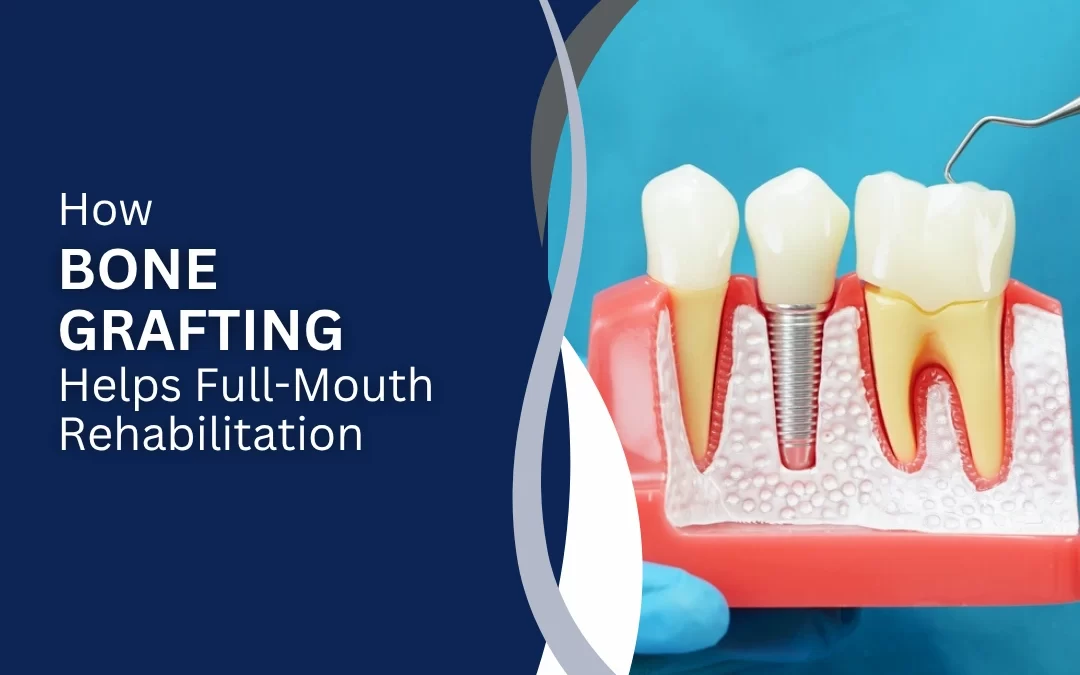 bone grafting