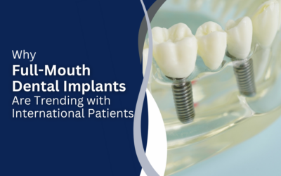 Why Full-Mouth Dental Implants Are Trending with International Patients