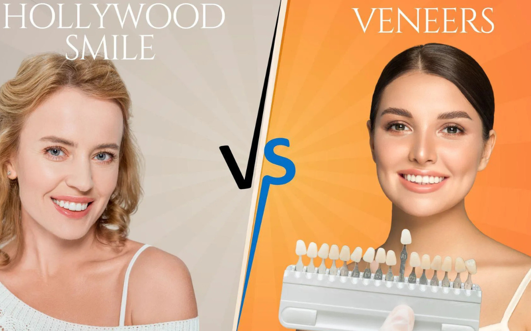 Split-screen comparison of a smiling woman with a 'Hollywood Smile' on the left and another smiling woman with a veneer shade guide on the right, against bright backgrounds.